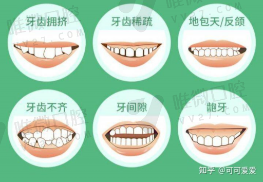 钴铬钼假牙和钴铬假牙区别,钴铬钼合金名字(图1)